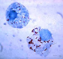 "Rickettsia rickettsii" (red dots) in the cell of a deer tick