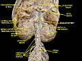 Spinal cord. Brachial plexus. Cerebrum.Inferior view.Deep dissection.